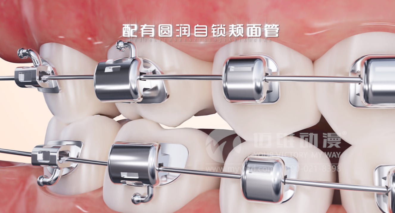 華文7D自鎖托槽產品展示三維動畫(圖1)
